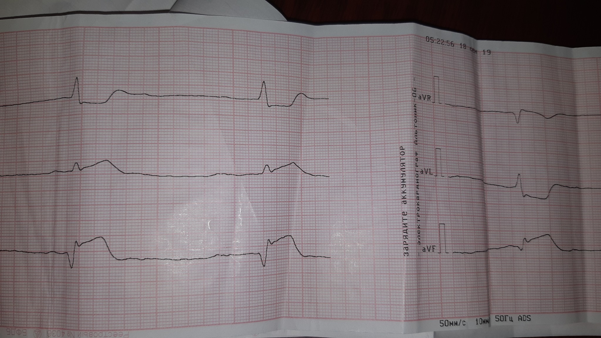 Days of cardio... - My, Weekdays, Doctors, A life, Republic of Belarus, The rescue, 2019, Longpost