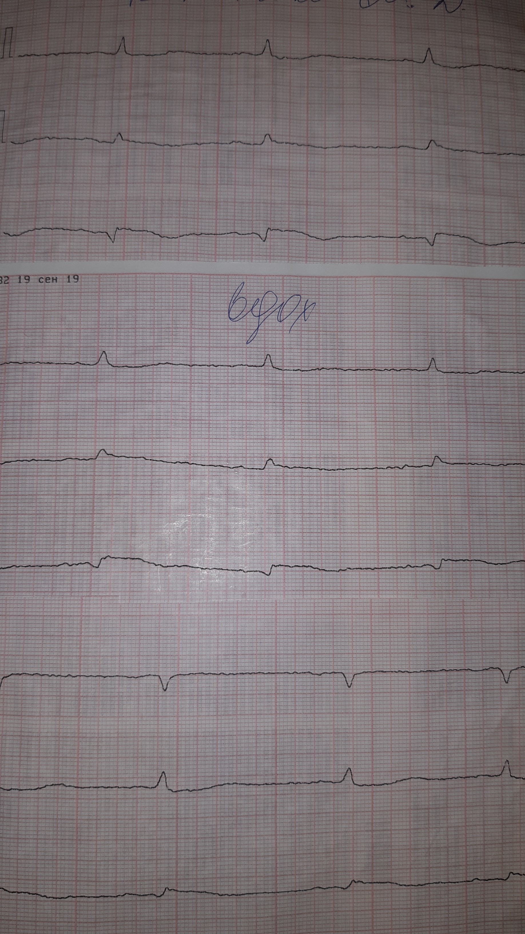 Days of cardio... - My, Weekdays, Doctors, A life, Republic of Belarus, The rescue, 2019, Longpost