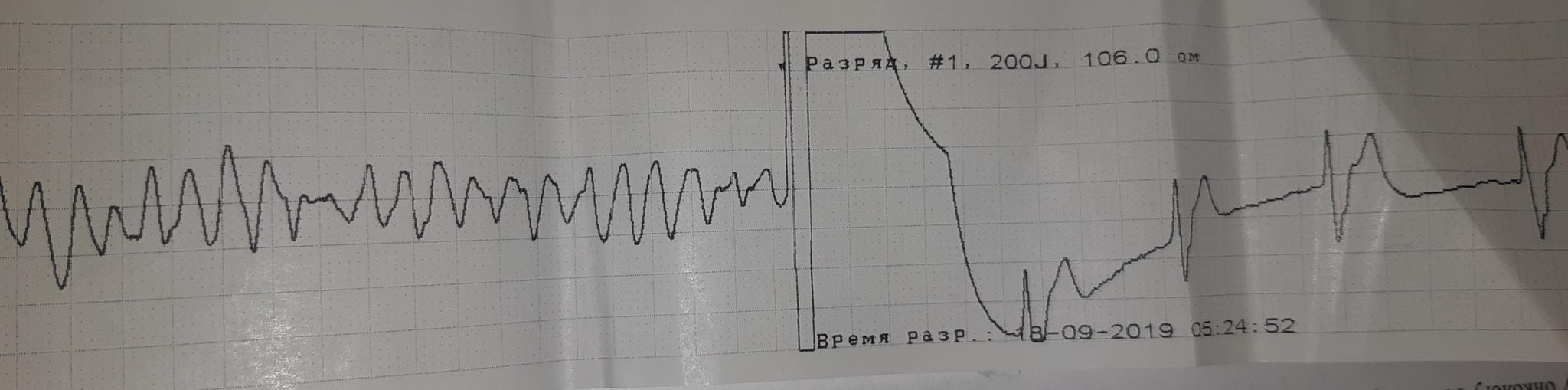 Days of cardio... - My, Weekdays, Doctors, A life, Republic of Belarus, The rescue, 2019, Longpost