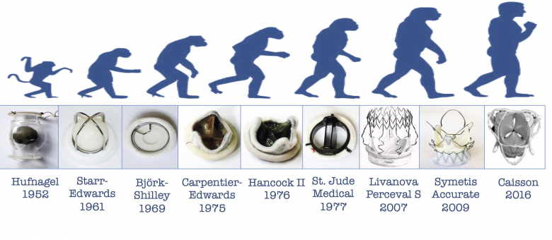 September 21 - First human mitral valve replacement - September, The medicine, Story, Cardiac surgery, The calendar, Longpost