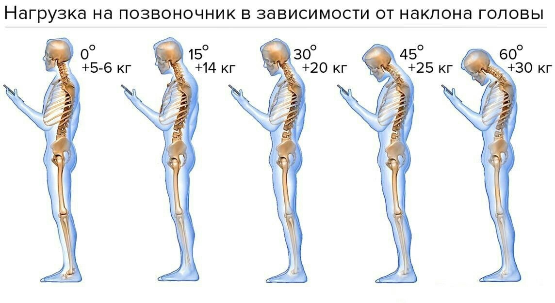 beware) - Important, Health, Slope, Spine, Load