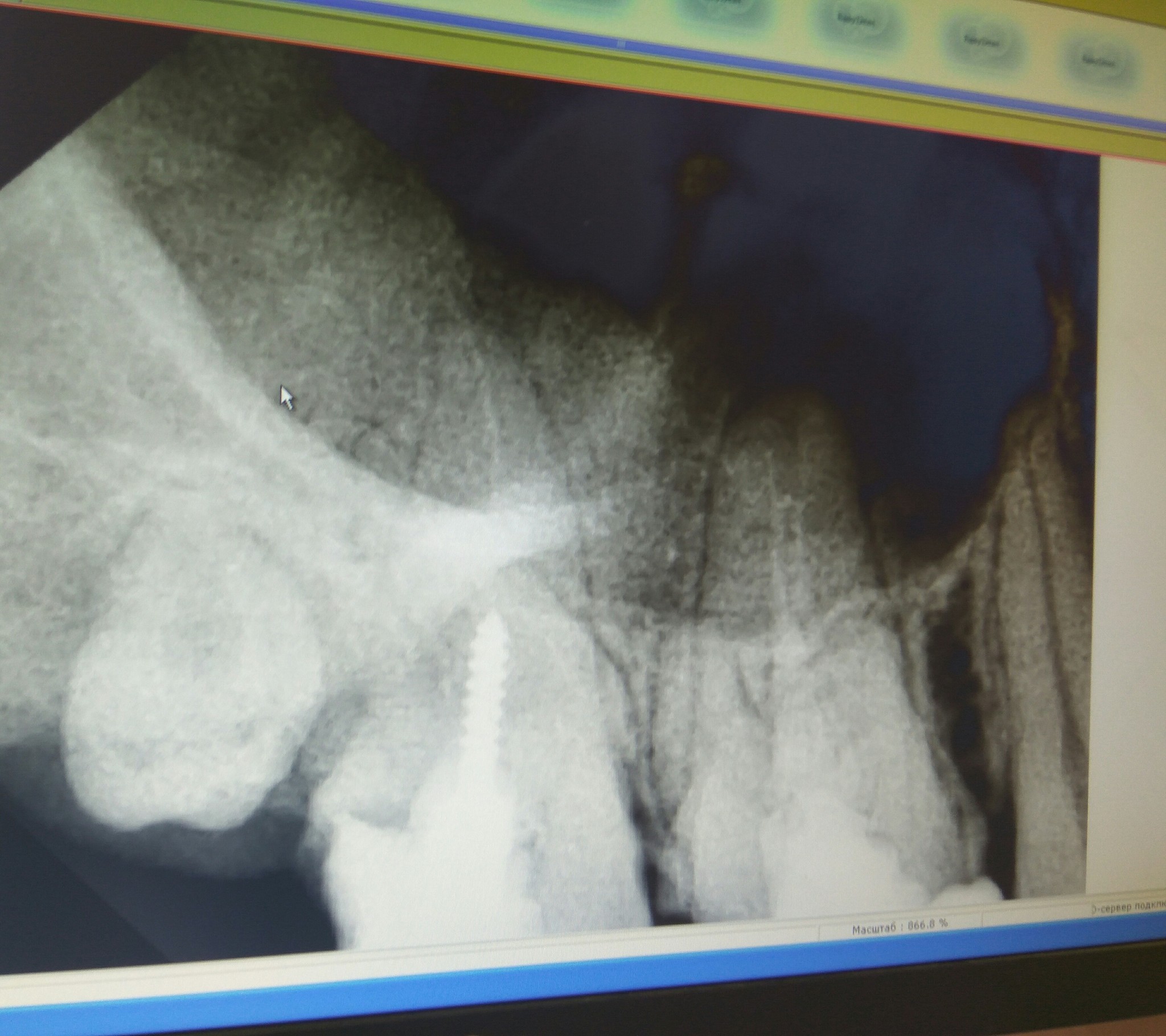 Woe-stomatologist. - My, Teeth, Dentist, Mat, Longpost