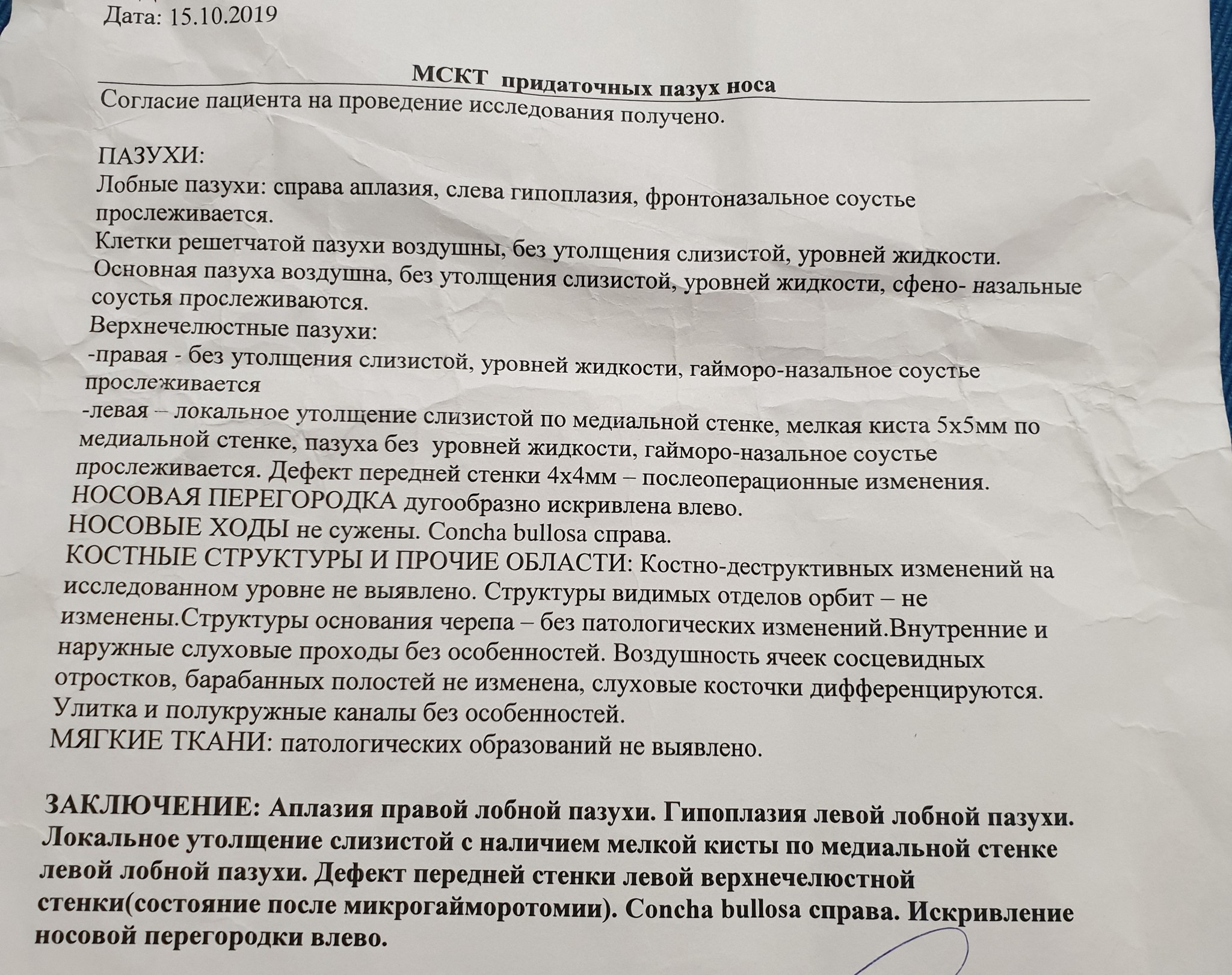 А может просто не стоило или моя подруга - Моё, Длиннопост, Гайморит, Гайморотомия, Подруга