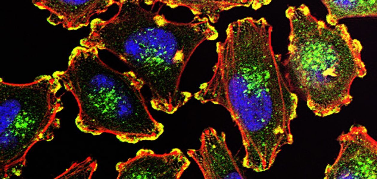 Successful embryo development and vulnerability to cancer are two sides of the same coin - Embryo, Embryonic development, Cancer and oncology, Metastases