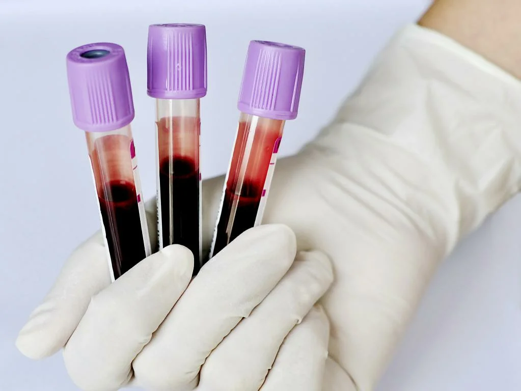 Determination of blood groups in the laboratory - My, Blood test, Blood type, Laboratory, The medicine, Longpost, Analysis