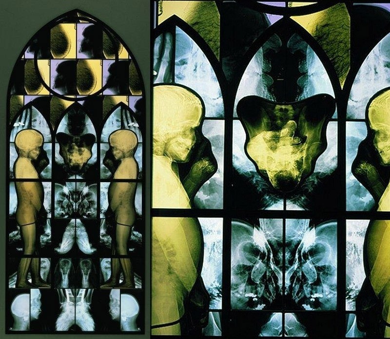 Stained glass from X-rays - X-ray, Stained glass, Longpost