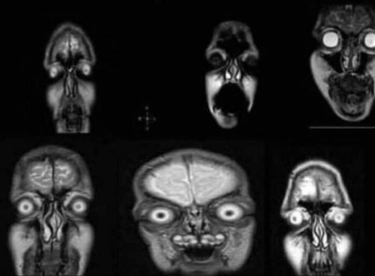 These spirits are offended by your jokes! - MRI, Radiology, Kripota