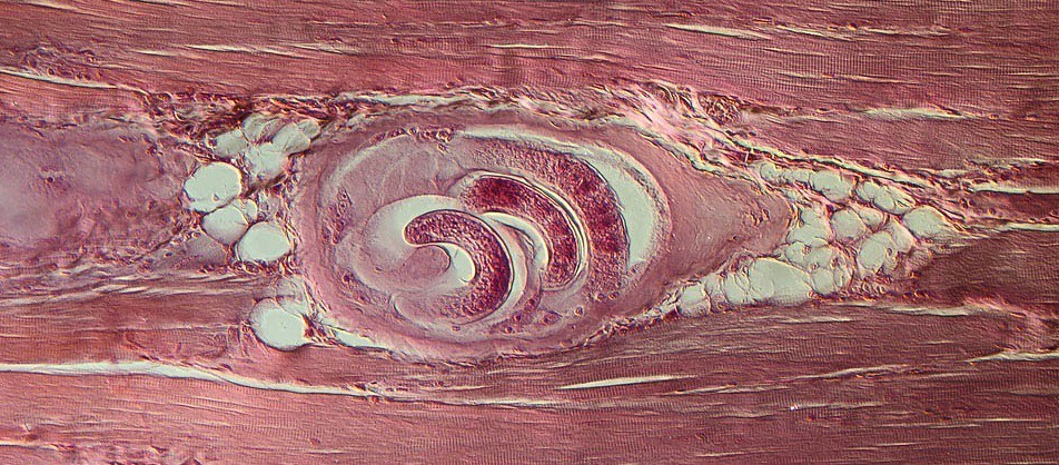 Trigger points - where do they come from? Perhaps these are parasites? - My, Parasites, Trigger, The medicine, Video, Longpost