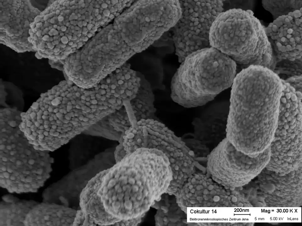 The evolution of living organisms happening right before our eyes - My, Bacteria, Virus, AIDS, Hiv, Plague, Rabies, Evolution, Rabbit, Longpost