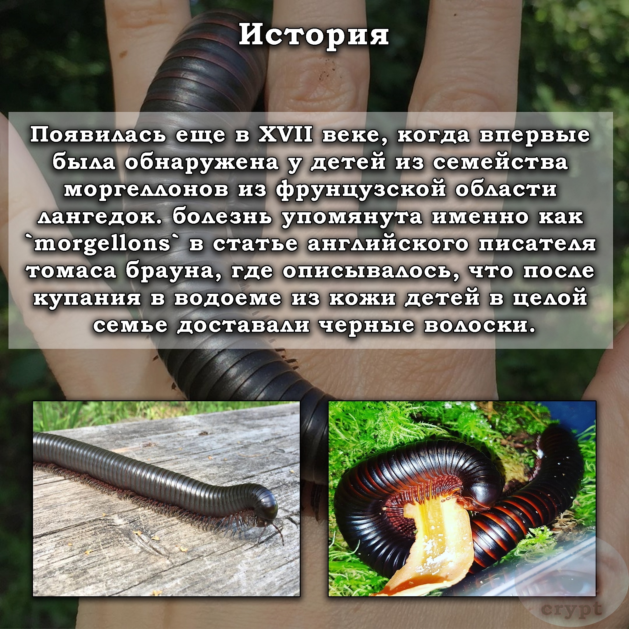 Моргеллонова болезнь | Пикабу