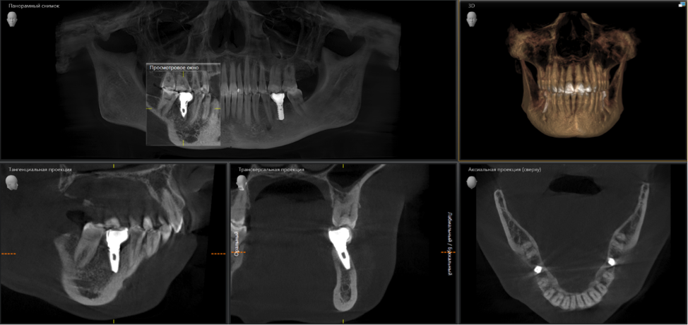 Dentistry: expectation and reality - My, Dentist, Dentistry, Surgeon, Doctors, Teeth, Dental implantation, The medicine, Doctor, Longpost