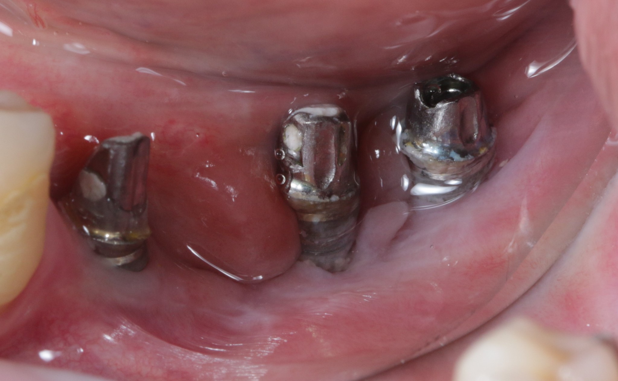 Dentistry: expectation and reality - My, Dentist, Dentistry, Surgeon, Doctors, Teeth, Dental implantation, The medicine, Doctor, Longpost