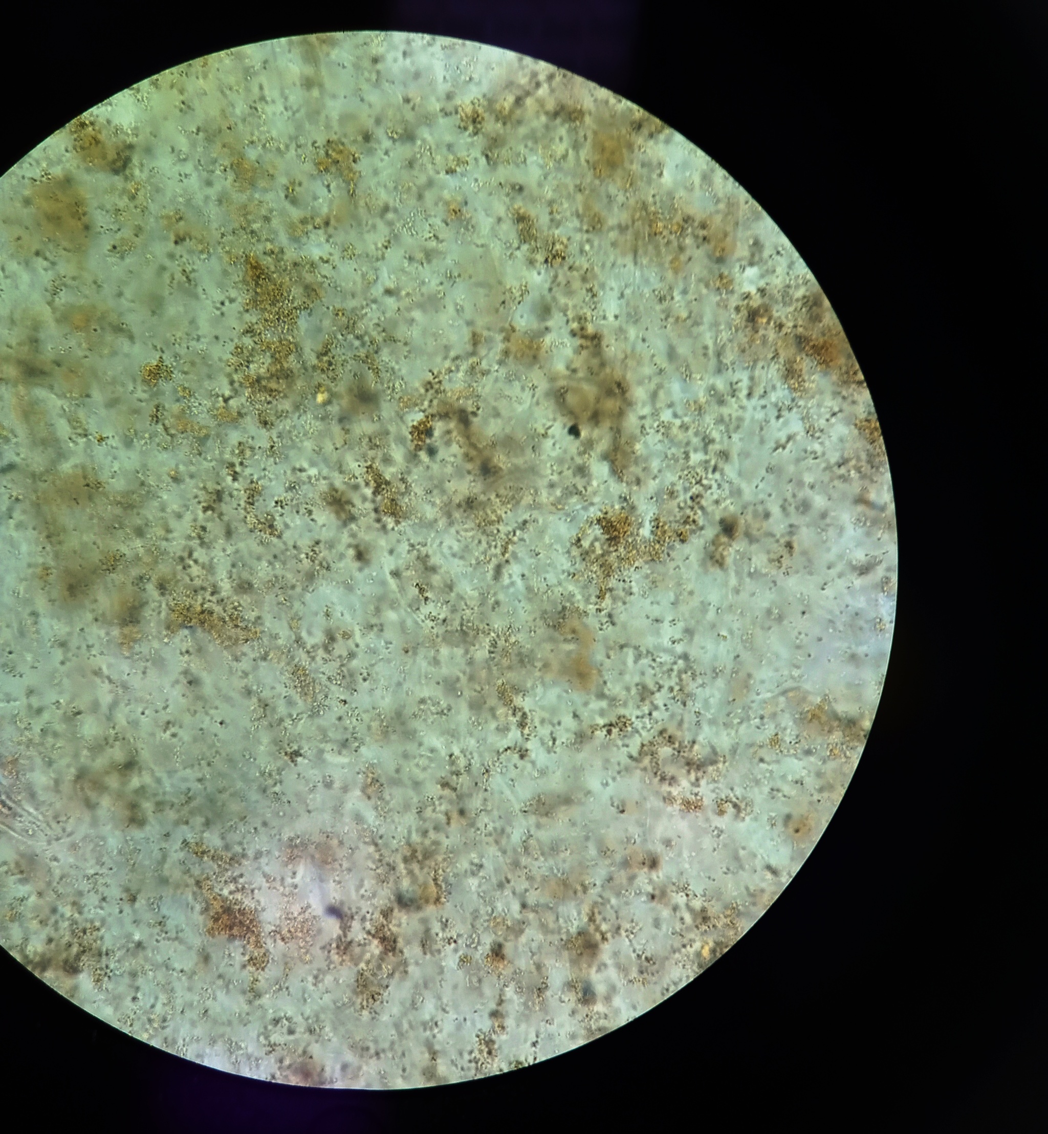Amorphous urates in urine sediment - My, Kld, Laboratory, Microscope, Microscopy, Analysis, Urine, The medicine