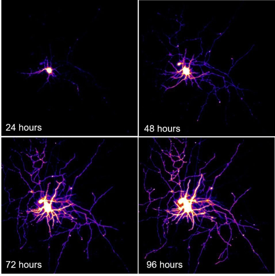 How neurons grow - My, The science, Brain, Neurons, Images, Biology, The medicine