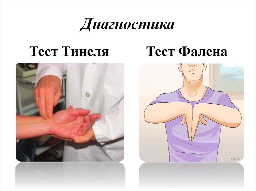 It gives me goosebumps. Carpal tunnel syndrome. NeuroMemoBlog - My, Neurology, The medicine, Efficiency, Treatment, Numbness, Saint Petersburg, Longpost