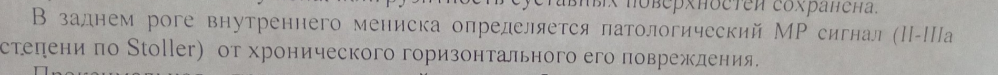 Что значит повреждение мениска 2-3 а степени по столлер? - Повреждения, Детская травма, Операция