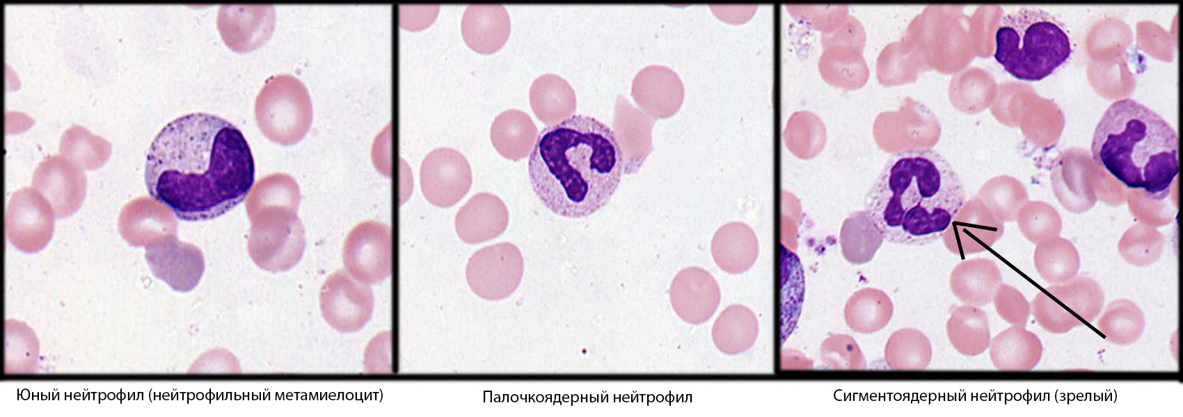 Кровь под микроскопом – фото