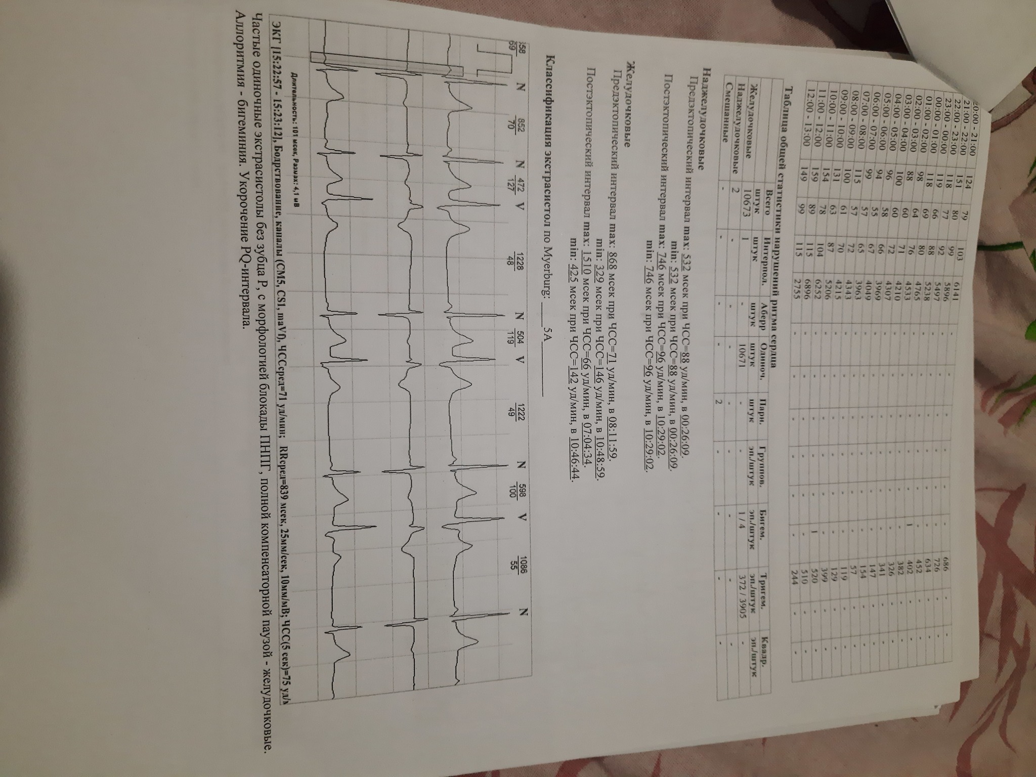 Extrasystoles... How to deal with them? - My, Cardiology, Arrythmia, The medicine, Arrhythmia, No rating, Longpost