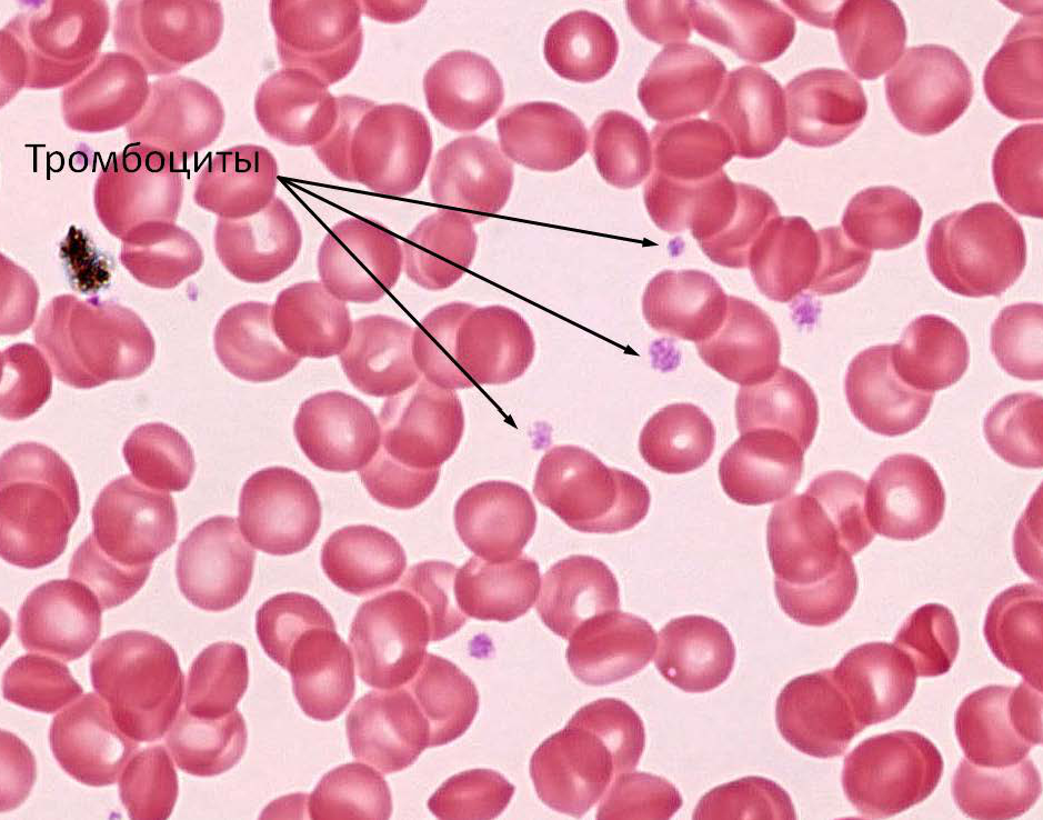 Тромбоциты микроскопия. Тромбоциты в крови гистология. Клетки крови гистология тромбоцит. Клетки крови гистология тромбоциты препарат. Тромбоциты под микроскопом гистология.