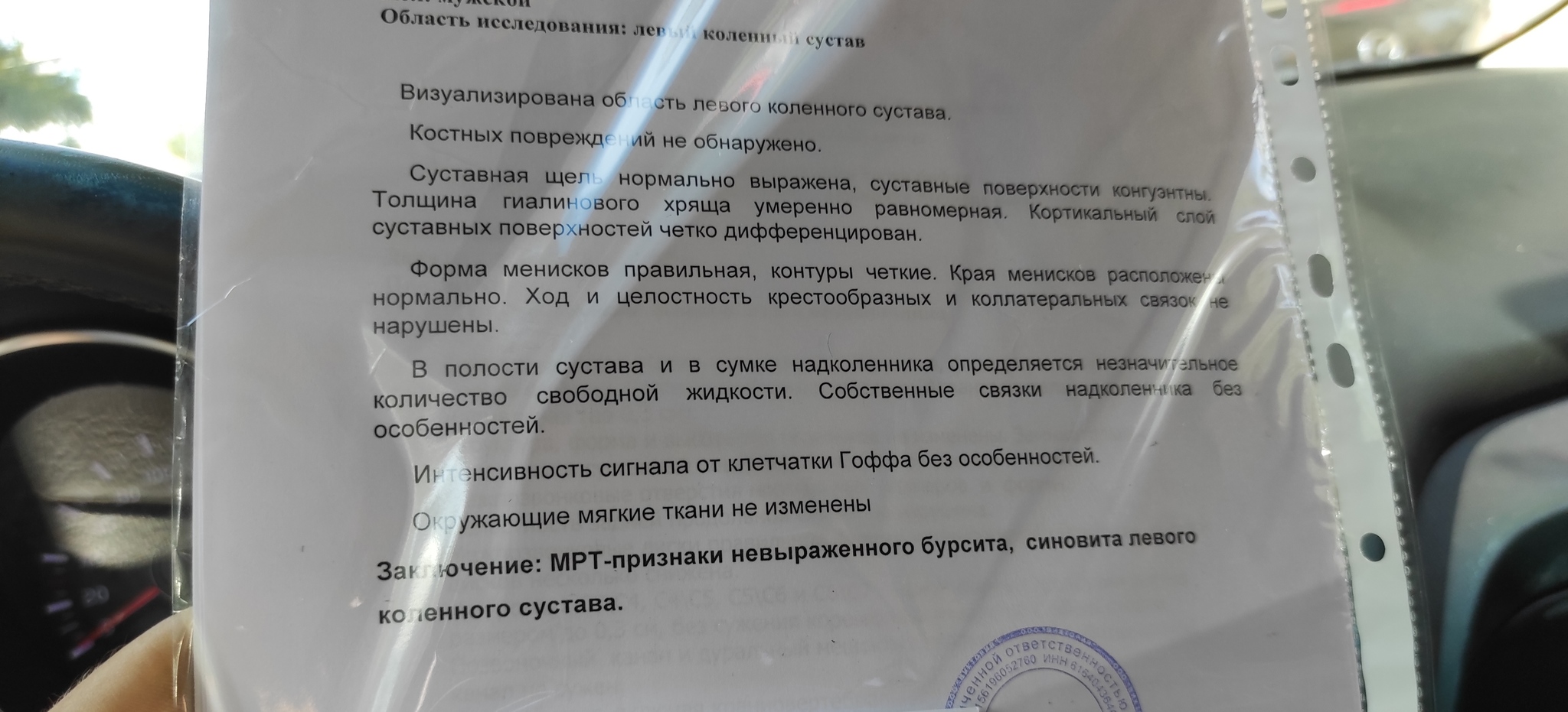 Здравствуйте, нужна помощь знающих людей - Без рейтинга, Военкомат, Болезнь, Нужна помощь врачей, Длиннопост, Неврология