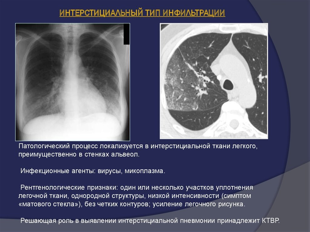 Let me go back in time - My, Coronavirus, Pandemic, Longpost