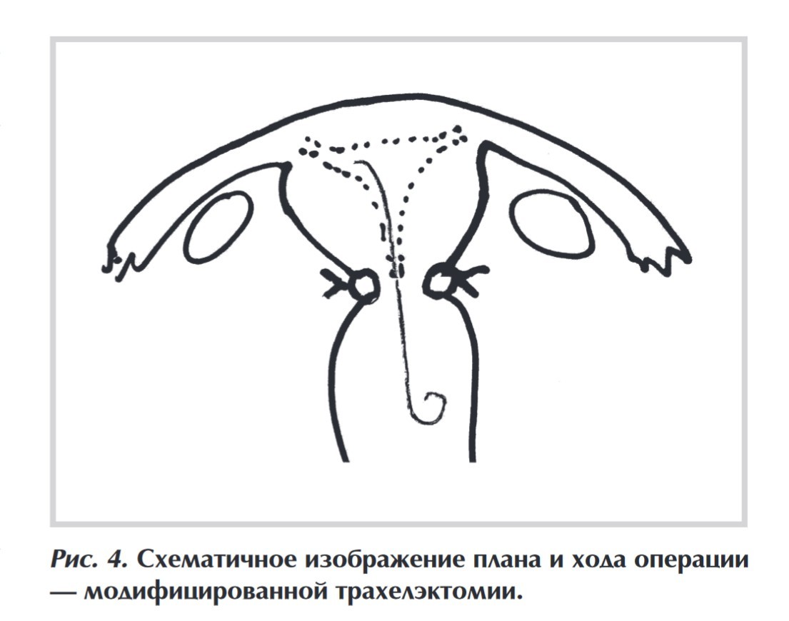 Клинический случай 