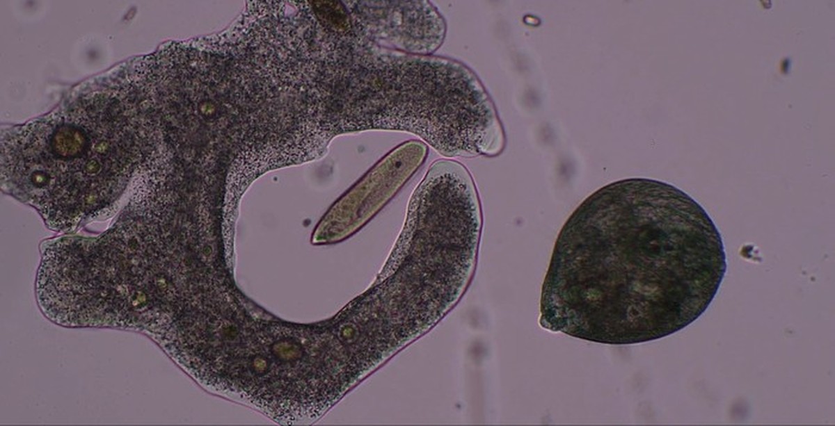 Инфузория туфелька ложноножки. Инфузория туфелька и амеба под микроскопом. Amoeba Proteus под микроскопом. Фагоцитоз амебы. Фагоцитоз микроскоп.